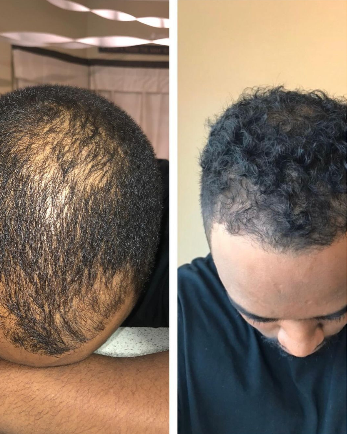 Before and after result