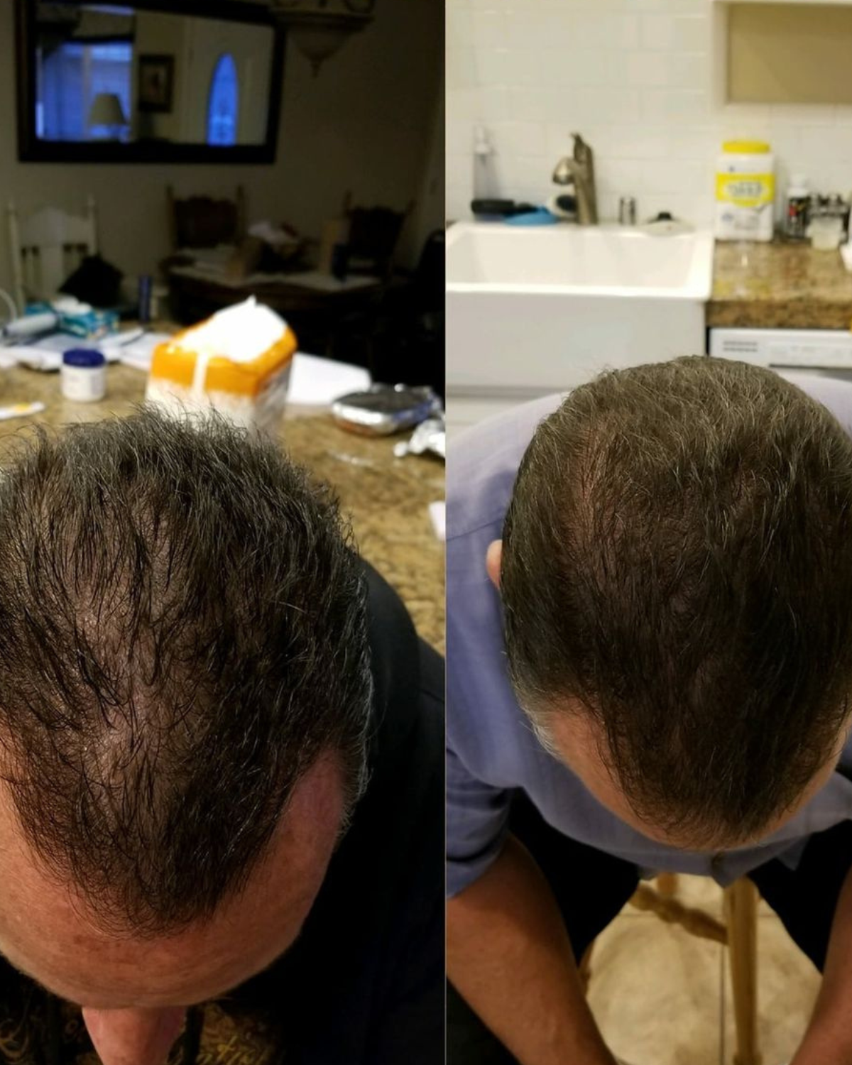 Before and after result